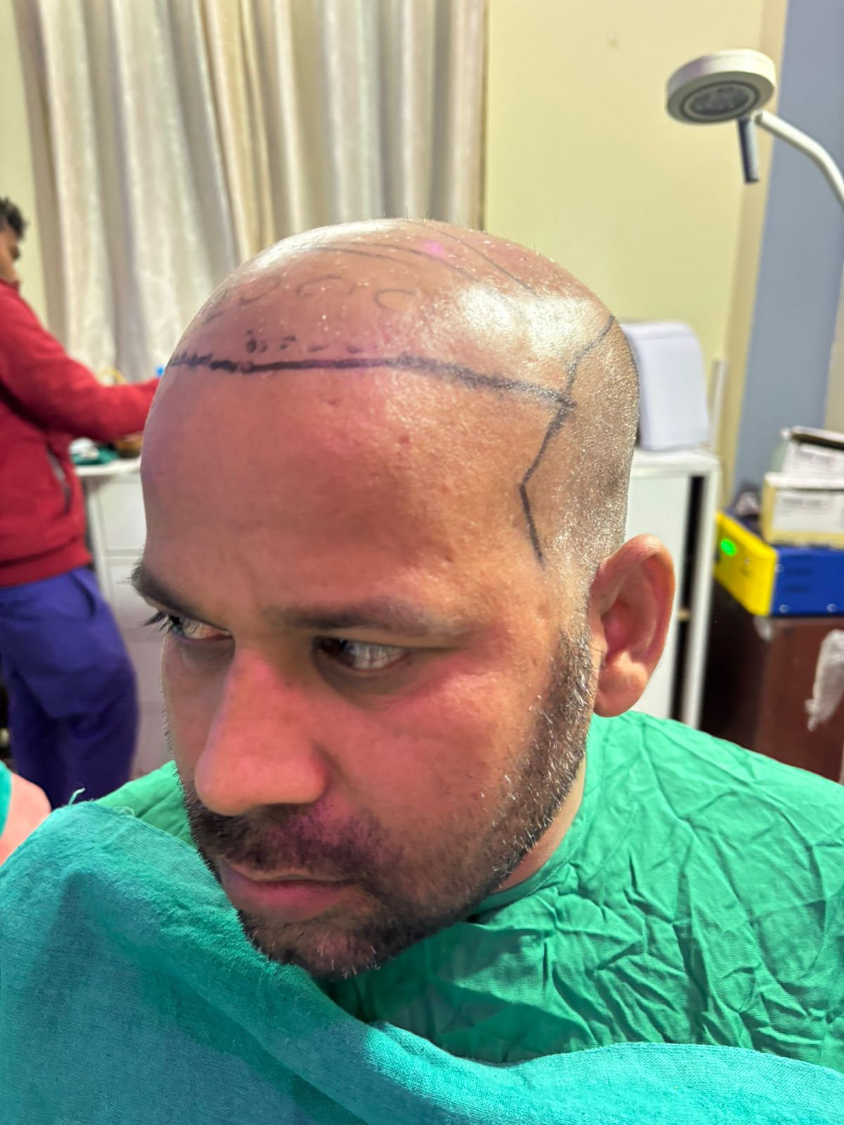 Anti-Aging Treatment Results